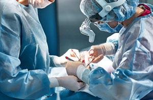 Rhinoplasty Surgeon UK or Near Me