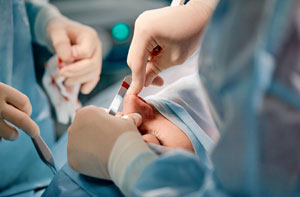 Rhinoplasty Surgeon Basingstoke Hampshire or Near Me