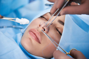 Rhinoplasty Surgery Basingstoke UK